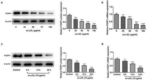 Figure 1. FOXP1 expression was notably decreased in ox-LDL-induced RAW264.7 cells. The (a) protein expression and (b) mRNA expression of FOXP1 in RAW264.7 cells exposed to 25, 50, 75 and 100 μg/ml ox-LDL for 24 h were analyzed with Western blotting and RT-qPCR. The (c) protein expression and (d) mRNA expression of FOXP1 in RAW264.7 cells induced with 75 μg/ml ox-LDL for 6 h, 12 h or 24 h were analyzed with Western blotting and RT-qPCR. *P < 0.05, **P < 0.01, ***P < 0.001 vs. control.