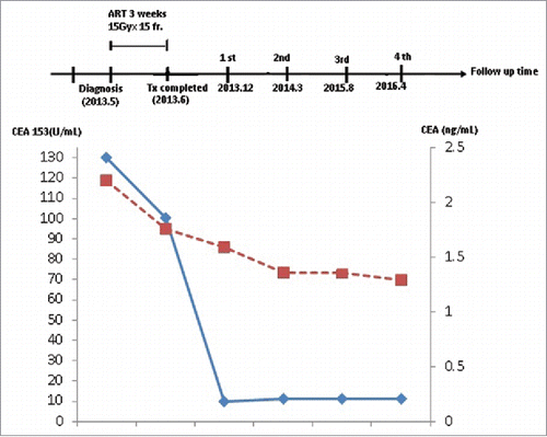 Figure 4. Time course of breast cancer biomarkers. The time course during follow-up shows changes in the serum tumor biomarkers, CEA 153 and CEA, after modified ablative radiotherapy.