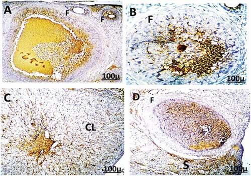Figure 11. Immunohistochemistry showing caspase-3 streptavidin-biotin- peroxidase staining method in ovarian tissue of adult female rat treated with (4 mg/kg of AgNps) high dose, Showing positive and extreme expression of immune stain caspase-3.
