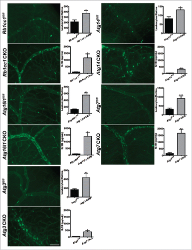 Figure 3. Loss of autophagy promotes uveitis. Representative images of concavalin A lectin- perfused retinal flatmounts from Rb1cc1 CKO (n = 17 vs. n = 10), Atg14 CKO (n = 8 vs. n = 16), Atg16l1 CKO (n = 7 vs. n = 14), Atg7 CKO (n = 9 vs n = 7), and Atg3 CKO (n = 17 vs n = 8) mice and littermate controls with corresponding quantification of adhered leukocytes per retina and serum IL1B levels for each genotype. Scale bar: 100 µm. All data are represented as mean ± SEM. Student t test or Mann-Whitney U-test *, P < 0.05; **, P < 0.01; ***, P < 0.001.