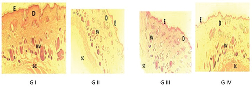 Figure 12. Effect of Annona muricata leaves extract on histopathological evaluation.
