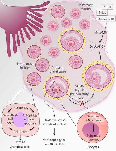 Figure 6. Autophagy adaptations during anovulation associated with PCOS. An altered population of follicles at the initial stages of follicular development including, an increase in the number of primary follicles and pre-antral follicles. Autophagy causes granulosa cell death in the pre-antral follicle and leads to follicular atresia. Heightened mitophagy in the cumulus cells in response to oxidative stress in follicular fluid. Defective mitophagy causes oocyte damage causes deformation of oocytes. Autophagy prevents the transition of antral follicles to the pre-ovulatory stage and opposes ovulation. An increase in the level of INS, LH, and testosterone prevents ovulation by augmenting the cAMP level