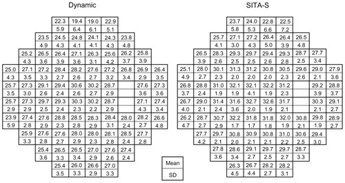 Figure 1 Mean retinal sensitivities at each test point in Dynamic and SITA-S.