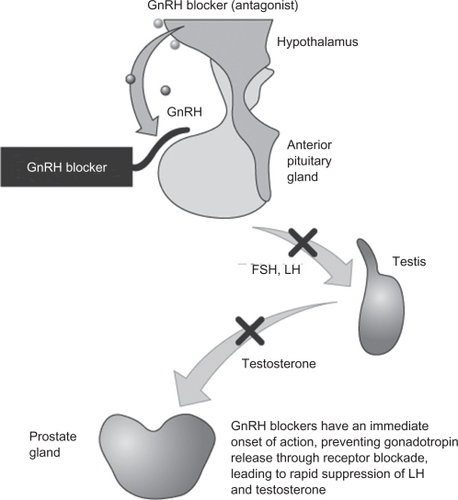 Figure 1 Mode of action of GnRH receptor antagonists.Citation58 Reproduced with permission from Anderson J. Degarelix: a novel gonadotropin-releasing hormone blocker for the treatment of prostate cancer. Future Oncol. 2009;5(4):433–443.Citation58 Copyright © 2009 Future Medicine Ltd.Abbreviations: GnRH, gonadotrophin-releasing hormone; FSH, follicle-stimulating hormone; LH, luteinizing hormone.