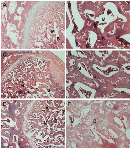 Figure 10 Hematoxylin and eosin-stained section of n-CDAP/PCL–PEG–PCL composite scaffolds implanted into bone defects of rabbit femora for (A and B) 1, (C and D) 2, and (E and F) 3 months. M represents gradually degraded materials and B represents new bone tissue, respectively.Abbreviation: n-CDAP-PCL–PEG–PCL, nano calcium-deficient apatite and poly (ɛ-caprolactone)–poly(ethyleneglycol)–poly(ɛ-caprolactone).