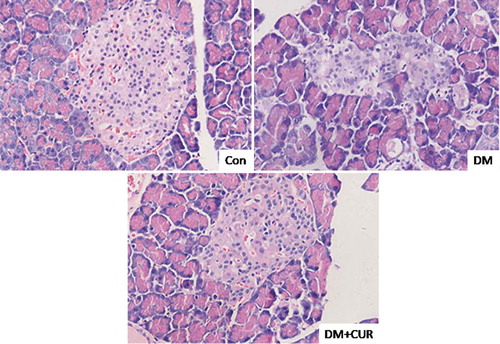 Figure 4. Effect of curcumin on histological abnormalities of islet cells in STZ-induced DM rats. Pancreatic tissue was sectioned at 5 μm and the slides were stained with hematoxylin and eosin. Representative images fromlongitudinal and transverse H&E staining for pancreatic tissue were shown. All images were obtained by microscope with 400× amplification. CUR, curcumin; STZ, streptozotocin; DM, diabetes mellitus; Con, control.