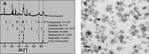 Figure 1 Characterization of ferumoxytol nanoparticles.Notes: (A) X-ray diffraction patterns of ferumoxytol iron oxide nanoparticles, (B) TEM of ferumoxytol cores. Reprinted from Elsevier and European Journal of Pharmaceutics and Biopharmaceutics, 78(3), Jahn MR, Andreasen HB, Futterer S, et al, A comparative study of the physicochemical properties of iron isomaltoside 1000 (Monofer®), a new intravenous iron preparation and its clinical implications, 480–491, Copyright 2011, with permission from Elsevier.Citation29Abbreviation: TEM, transmission electron microscopy.