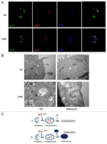 Figure 5. HIV-1 particles inside AV. (A) Confocal microscopy immunolocalization of the HIV-1 protein gp120 (green), LAMP1 (red) and the tetraspanin CD63 (blue) on PBMC from NP and LTNP. (B) Ultrastructural images of PBMC from NP and LTNP patients showing VCCs that carried viral particles or viral components. An AV containing a mitochondrion was visible in bafilomycin A1-treated PBMC from NP (arrow). Control cells from LTNP showed a double-membrane AV containing viral particles or viral components (arrow). Bafilomycin-A1-treated LTNP PBMC showed a very large AV containing undigested material and viral particles or viral components (arrow). (C) Hypothetical mechanism of HIV-1 removal by autophagy. HIV-1 particles (red), budding into VCC, or viral components (black), can be captured by autophagosomes. Then the viral components degradation can be blocked by viral-specific protein/s in NP (C1). In contrast, HIV-1 components can get digested in autolysosomes in HIV-1 controllers (C2). Original magnification: (A) 63×; (B) NP Ctrl 30,000×, NP bafilomycin A1 30,000×, LTNP Ctrl 50,000×, LTNP bafilomycin A1 50,000×.