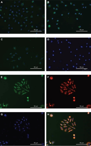 Figure 3 Mouse bone marrow-derived MNCs differentiate into cells with endothelial progenitor cell-like characteristics after expansion in vitro.Notes: Immunocytochemical analysis of cells cultured for 7 days revealed the expression of the mouse endothelial cell markers CD31 (A), vWF (B), and KDR (C). All antibodies were directly labeled with FITC. Cell nuclei were stained with DAPI. Control cells were incubated with PBS in place of primary antibody (D). These exhibited uptake of acetylated LDL (F) and bound FITC-labeled lectin (E) after 7 days in culture. Cell nuclei were stained with DAPI (G). H) Overlap of these three images. Magnification: ×200.Abbreviations: DAPI, 4′,6-diamidino-2-phenylindole; FITC, fluorescein isothiocyanate; KDR, kinase domain receptor; LDL, low-density lipoprotein; MNCs, mononuclear cells; PBS, phosphate-buffered saline; vWF, von Willebrand factor.