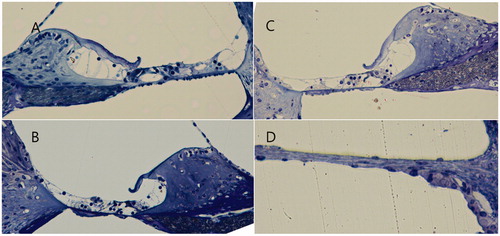 Figure 7. Light microscopy images of the organ of Corti and round window membrane of the nanoparticle group. The structures of the organ of Corti were well preserved at the apical (A), mid (B), basal (C) and turn of the cochlea, and the round window membrane showed a normal appearance (D).