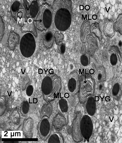 Figure 12.  Electron micrograph of a mature oocyte and a degenerating oocyte in female Protothaca (Notochione) jedoensis. The degenerating oocytes (DO). Note a number of degenerating yolk granules (DYG) surrounded with myelin-like organelles (MLO, arrow) in the cytoplasm of the degenerating oocyte (DO).