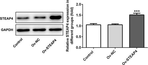 Figure 2 Overexpression of STEAP4 attenuated the inflammatory and oxidative stress induced by HG. The expression of STEAP4 was detected by Western blot after cell transfection. The transfected cells were high glucose-induced HRCECs. n=3 ***P<0.001 vs OV-NCAbbreviations: Ov-NC, overexpression-NC; Ov-STEAP4< overexpression-STEAP4; HG, high glucose.