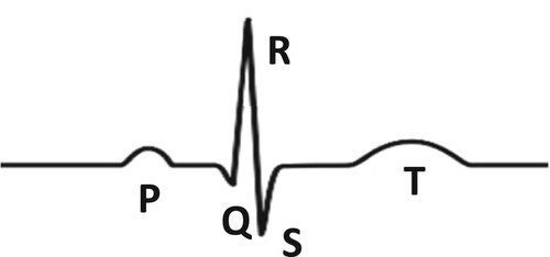 Figure 1. QRS compound.