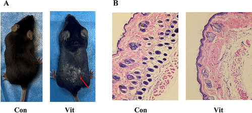 Figure 9 (A) Vitiligo mouse models: the red arrows indicate the MBEH application site, where the hair is significantly whitened. (B) HE staining results: the number of hair follicles in the control group was significantly higher than that in the vitiligo group; the distribution of melanin around the hair follicle was obvious.