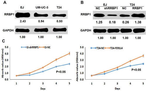 Figure 3 RRBP1 overexpression promoted cell proliferation in vitro. (A) The protein expression levels of RRBP1 were detected in bladder cancer cell lines by Western blot assay. (B) Western blot analysis revealed that RRBP1 downregulation and upregulation were successfully performed. (C) CCK-8 assay shows RRBP1 downregulation inhibited cell proliferation, while RRBP1 overexpression promoted cell proliferation.