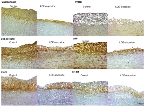 Figure 3 Immunohistochemistry of artery tissues from rabbits treated with saline solution (control group) or LDE-etoposide. Photomicrographs of diaminobenzidine chromogen immunostaining for macrophages, VSMC, LDL receptor, LRP-1, CD36, and SR-B1. Magnifications: 100×.Figure 4 Immunohistochemistry of artery tissues from rabbits treated with saline solution (control group) or LDE-etoposide. Photomicrographs of diaminobenzidine chromogen immunostaining for MMP9, IL-1β, TNF-α, PCNA, topoisomerase IIα, tubulin. Magnifications: 100×.Abbreviations: IL, interleukin; LDE, cholesterol-rich nanoemulsion; MMP9, matrix metallopeptidase 9; PCNA, proliferating cell nuclear antigen; TNF, tumor necrosis factor.Display full sizeAbbreviations: CD36, cluster of differentiation 36; LDE, cholesterol-rich nanoemulsion; LDL, low-density lipoprotein; LRP, LDL-related protein; SR-B1, scavenger receptor class B member 1; VSMC, vascular smooth muscle cells.