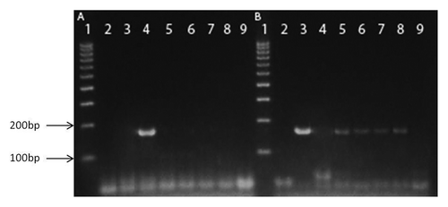 Figure 6.pncA allele-specific PCR. Amplifications were performed with chromosomal DNA from M. bovis (3); M. tuberculosis H37Rv (4); M. bovis BCG-BG, L-form (5); M. bovis BCG-D, L-form (6); M. bovis BCG-BG, filtered culture (7) and M. bovis BCG-D, filtered culture (8). PCR controls with water were also included, lines 2 and 9. All samples in gel A were tested with primers specific for M. tuberculosis, whereas all samples in gel B - with primers specific for M. bovis. DNA ladder (100–1000bp) was used in line 1 as size marker in both gels.