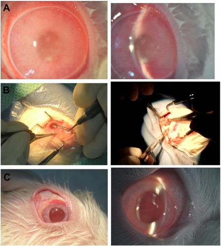 Figure 9 In the Staphylococcus aureus endophthalmitis rabbit model, the rabbit foldable capsular vitreous body (FCVB) with levofloxacin 625 μg/mL tamponade and the culture results of aqueous humor were sterile. (A) S. aureus endophthalmitis rabbit model, (B) surgery of FCVB tamponade, and (C) no signs of endophthalmitis were observed in the treated eye.