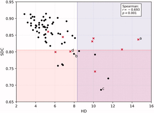 Figure 4. Scatterplot of 69 SMGs showing SDC vs HD and the criteria for both metrics to mark cases for suspicion of sub-optimal quality. Red crosses are those contours that were actually deemed to be sub-optimal on review, black dots in the shaded areas are considered false positives, red crosses in the unshaded area are false negatives. Letters a-d refer to the respective images in Figure 5.