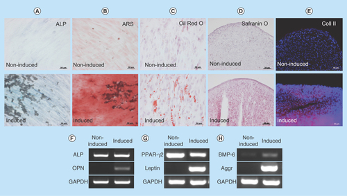 Figure 2.  Induction of differentiation into mesenchymal cells.(A) ALP staining, (B) ARS staining, (C) oil red O staining, (D) safranin O staining and (E) immunohistochemistry of Coll II in noninduced (upper panel) and induced (lower panel) human oral mucosa middle interstitial tissue fibroblasts. Scale bars: 50 μm. Reverse transcription-PCR analysis shows (F) osteogenic (ALP, OPN), (G) adipogenic (PPAR-γ, leptin) and (H) chondrogenic (BMP-6, aggrecan)-specific gene expression. Primers used are listed in Table 3. GAPDH was used as an internal control. Left lane: noninduced human oral mucosa middle interstitial tissue fibroblasts; right lane: induced human oral mucosa middle interstitial tissue fibroblasts.ALP: Alkaline phosphatase; ARS: Alizarin red S; Aggr: Aggrecan; Coll II: Collagen type II; GAPDH: Glyceraldehyde-3-phosphate dehydogenase; OPN: Osteopontin; PPAR-γ: Peroxisome proliferator-activated receptor-γ.