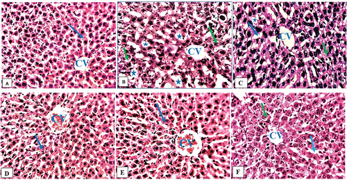 Figure 4. Composite photomicrographs of liver of control (a) showing normal hepatocytes (arrow) and central vein (CV), HgCl2 treated micrograph (b) exhibited remarkable degenerating hepatocyte (green arrow), and fat hepatocellular vacuoles (Asterix). Extract 25 mg/kg + 0.5 mg/kg HgCl2 (c) showed mild inflamed hepatocyte (green arrow) and mild dilatation of the sinusoid (blue arrow), Extract 50/75 mg/kg + 0.5 mg/kg HgCl2 (d & e) showing normal hepatocyte (arrow), Ascorbic Acid treated group (f), showed mild dilatation of the sinusoid (blue arrow), and mild inflamed hepatocyte (green arrow).