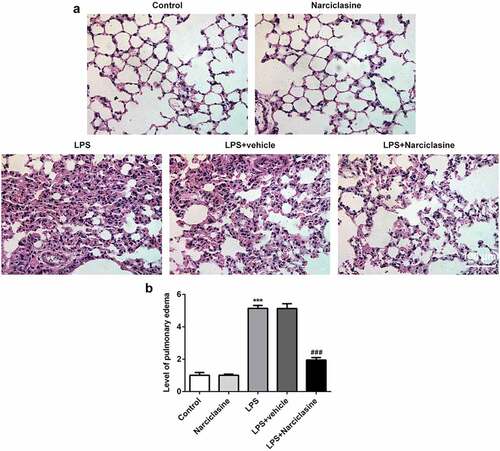 Figure 1. Effects of narciclasine on pulmonary injury. (a) Representative images of hematoxylin and eosin (H&E) staining on lung tissues in different groups (scale bars = 100 μm). (b) Pulmonary edema was determined by pulmonary edema score. Data are presented as the mean ± standard deviation (n = 5). ***P < 0.001 vs. Control; ###P < 0.001 vs. LPS.