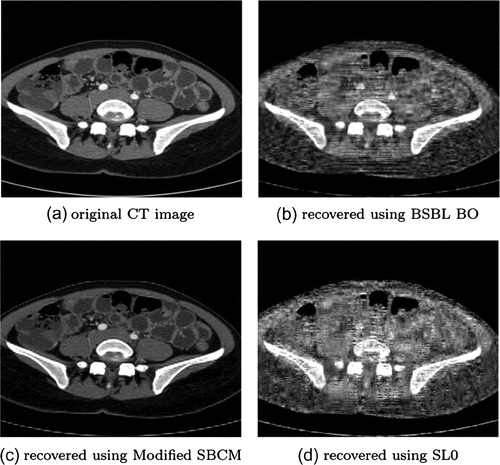 Figure 5. CT-abdomen original and recovered images of size 256×256.