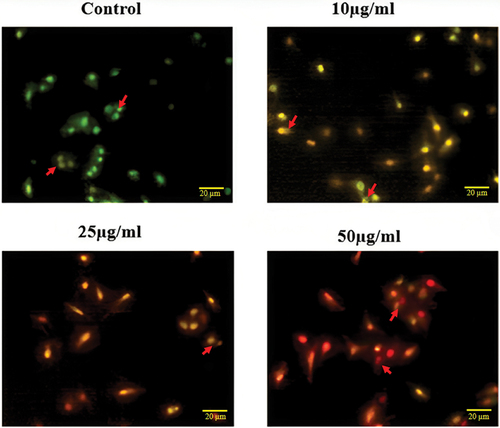 Figure 12. Ao/etbr staining of aqueous extract of Momordica charantia L. silver nanoparticles against MCF-7 cancer cell.