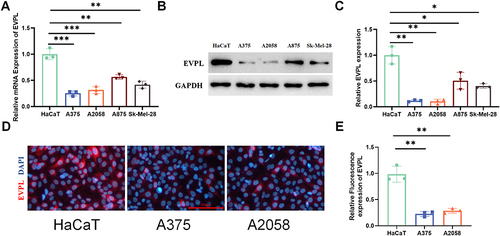 Figure 11 EVPL is lowly expressed in melanoma. (A) qRT-PCR analysis of EVPL expression changes in different melanoma cells, n=3. (B and C) The expression of EVPL in different cells detected by Western blotting, n=3. (D and E) The expression of EVPL in different cells detected by cell immunofluorescence staining, with red denoting EVPL, and blue denoting nucleus, n=3. The data in the figures represent the mean±SD. * Represents P< 0.05, ** Represents P<0.01, *** Represents P<0.001.