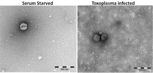 Fig. 1 Electron microscopy of vesicle preparations. SS and Toxo vesicle-enriched samples were negative stained and revealed extracellular vesicles of approximately 80–90 nm, the correct dimensions for exosomes.
