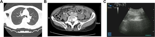 Figure 3 Images of this case after a completed treatment. (A) CT images of lung; (B) CT images of abdomen; (C), ultrasonic images of the right psoas muscle.