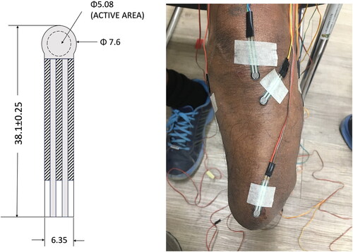 Figure 2. FSR400 Illustration and image of sensor placement on the residual limb.