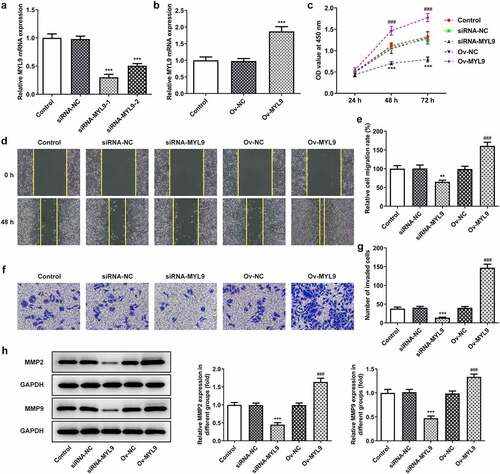 Figure 2. MYL9 affected cell proliferation, migration and invasion of colorectal cancer cells after overexpression or knockdown of MYL9. (a) Detection of MYL9 mRNA expression after transfection with siRNA-MYL9-1 or siRNA-MYL9-2 in HCT116 cells by RT-qPCR assay. ***P < 0.001 vs. siRNA-NC. (b) Inspection of overexpression of MYL9 in colorectal cancer cell lines was carried out by RT-qPCR. ***P < 0.001 vs. Ov-NC. (c) CCK-8 was adopted to detect cell proliferation levels. (d-e) Wound healing was used to evaluate the ability of cell migration. (f-g) Transwell assay was performed for cell invasion. (h). Western blot assay was used to test the expression of MMP2 and MMP9. **P < 0.01, ***P < 0.001 vs. siRNA-NC; ###P < 0.001 vs. Ov-NC.