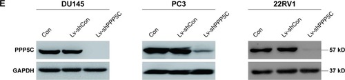 Figure 2 Lentivirus-mediated interference downregulates PPP5C expression in PCa cells.