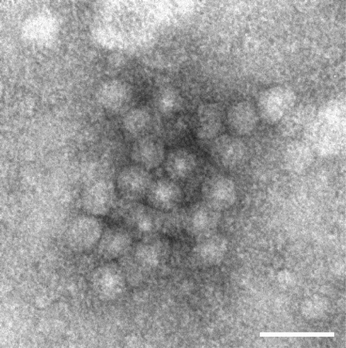 Figure 2. Electron micrograph of the JS1 GPV particles. Bar = 50 nm.