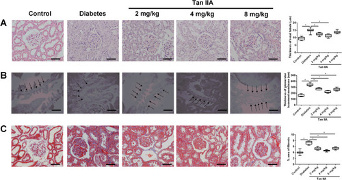 Figure 2 Tan IIA ameliorates the pathological changes in the renal tissues of the diabetic rats. (A) Thickness of renal tubules among different treatment groups were determined by HE staining. Scale bar: 50 μm (×400). (B) Thickening of glomerular basement membrane (GBM, indicated by arrows) among different treatment groups was determined by TEM. The pooled data from five sections for each group is summarized. Scale bar: 2 μm (×7900). (C) The distribution of collagens (blue color) stained with Masson’s trichrome staining in renal tissue from different groups was evaluated. Scale bar: 50 μm (×400). N = 10; *P<0.05.