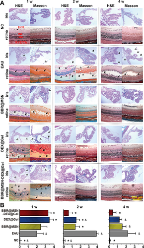 Figure 6 Histopathological examination. (A) Representative images of eye tissues, and (B) inflammatory evaluation scores in NC, EAU, and the treated groups (BBR@MSN, DEX@Gel and BBR@MSN-DEX@Gel, n = 3). At week 1, 2 and 4 after EAU and administration of the therapeutic formulations, all eyes were fixed and the tissue sections of retina and iris were stained by H&E and Masson. Several noteworthy histological reactions were pointed out with specific indicators, including # (inflammatory exudation), Δ (disorganization or detachment), arrow (retinal fold). *p<0.05 vs EAU and &p<0.05 vs BBR@MSN-DEX@Gel (Two-way ANOVA).