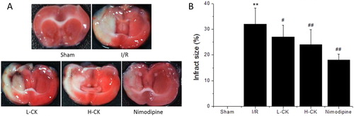 Figure 2. Effect of ginsenoside CK on the infarct volume ratio of rats. Note: Values are means ± SD (n = 6). Compared with the Sham group, **P < 0.01; compared with the I/R group, # P < 0.05, ##P < 0.01.