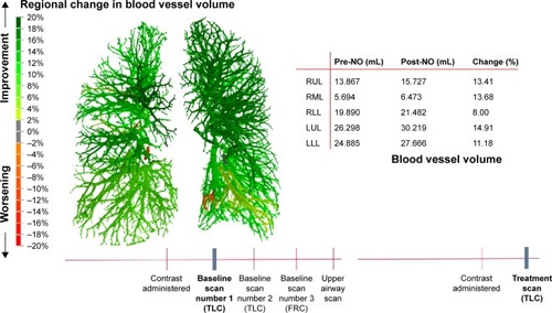 Figure 3 Segmented blood vessel model can be colored to display the regional change in volume after 20 minutes of iNO treatment.Abbreviations: FRC, functional residual capacity; LLL, left lower lobe; LUL, left upper lobe; RLL, right lower lobe; RML, right middle lobe; RUL, right upper lobe; TLC, total lung capacity; pre-NO, pre-nitric oxide inhalation; post-NO, post-nitric oxide inhalation.