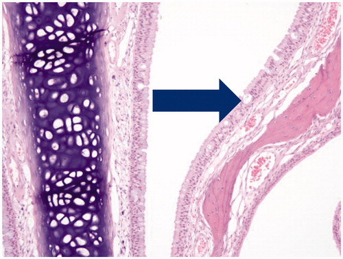 Figure 3. Photomicrograph of section through nose of male rat at nasal section 1 depicting mucus cell hyperplasia of the epithelium after 90-days inhalation exposure to high dose of Formulation 2 (20 × magnification).