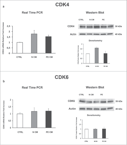 Figure 6. CDK4and CDK6 gene and protein expression levels in physiological placental villous explants treated with culture media conditioned by normal or PE-PDMSC. (A) CDK4 mRNA (left panels) and protein (right panels) expression levels in physiological villous explants treated with unconditioned media (CTRL, n = 16 explants) or media conditioned by normal (N CM, n = 16 explants) and preeclamptic (PE CM, n = 16 explants) PDMSCs as assessed by Real Time PCR and Western Blot analysis. B) CDK6 mRNA (left panels) and protein (right panels) expression levels in physiological villous explants treated with unconditioned media (CTRL, n = 16 explants) or media conditioned by normal (N CM, n = 16 explants) and preeclamptic (PE CM, n = 16 explants) PDMSCs as assessed by Real Time PCR and Western Blot analysis. Statistical significance (*) has been considered as p < 0.05.