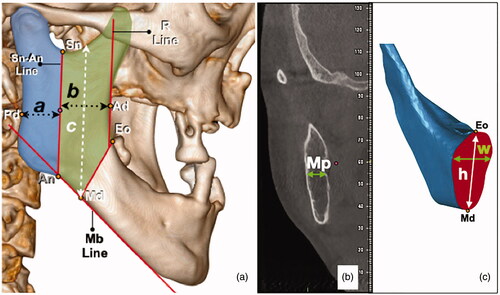 Figure 1. Picture on the left (a): the reference points and lines were marked, a and b indicates the smallest width of the posterior and anterior ramus respectively, c indicates the longest length of the planned anterior ramus graft. Picture in the middle (b): Mp is the width of the ramus bone at the mid-point of Sn-An Line. Picture on the right (c): the cross-sectional area of Eo-Md was marked red (x). The tallest and widest part of the cross section were also measured as h and w, respectively.