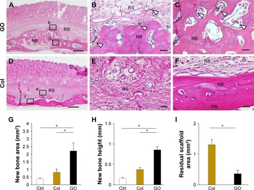 Figure 3 Histological findings after placement of GO scaffold on rat cranial bone.Notes: (A–C) GO scaffold. High magnification (B, C) of the framed areas (b, c) in (A). Black spots (white arrowheads) were found around the newly formed bone. (D–F) Collagen scaffold. High magnification (E, F) of the framed areas (e, f) in (D). Staining with H&E. Scale bars represent 1 mm (A, D) and 100 μm (B, C, E, F). (G–I) Histomorphometric measurements (N=6, mean ± SD) of new bone area (G), new bone height (H), and residual scaffold area (I). *P<0.05.Abbreviations: Col, collagen; Ctrl, control; GO, graphene oxide; NB, new bone; PB, preexisting bone; RS, residual scaffold.