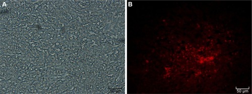 Figure 4 Engraftment of MSCs-OPG at the osteosarcoma site by fluorescence microscope (×4).