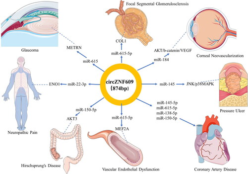 Figure 3. Functional roles of circZNF609 acting as microRNA sponges in human non-malignant diseases. The figures of human organs are from a free medical figure supplier Servier Medical Art (smart.servier.com).
