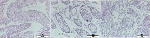 Figure 4 Testicular tissue between groups. (A) Tissue from control group (B) Testicular tissue from therapy group (C) Testicular tissue from group without therapy.