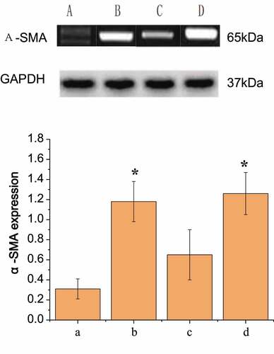 Figure 7. Comparison of the expression results of α-SMA in pericytes of each group