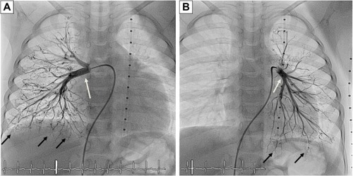 Figure 2 Cardiac catheterization.