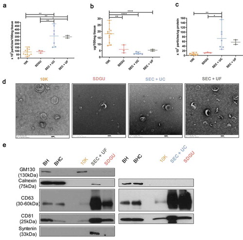Figure 2. Characterization of human bdEVs obtained by three combinations of methods. (a) Particle concentration of human bdEVs separated by three combinations of methods was measured by NTA (Particle Metrix). Particle concentration for each group was normalized by tissue mass (per 100 mg). (b) Protein concentration of human bdEVs separated by different methods and measured by BCA protein assay (per 100 mg tissue). (c) Ratio of particles to protein (particles/µg). (a–c): Data are presented as the mean with range. *p ≤ 0.05, **p ≤ 0.01, ***p ≤ 0.001, ****p ≤ 0.0001 by two-tailed Welch’s t-test. (d) bdEVs were visualized by negative staining transmission electron microscopy (scale bar = 100 nm). TEM is representative of five images taken of each fraction from three independent human tissue samples. (e) Western blot analysis of GM130, calnexin, CD81, CD63, and syntenin associated with BH and EV fractions. WB are representative of three independent human tissue EV separations from the SDGU and SEC+UC methods, and one independent human tissue EV separation from the SEC+UF method.