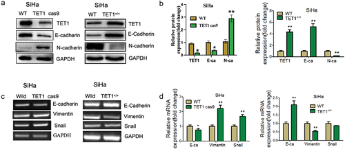 Figure 4. Effect of TET1 on epithelial-mesenchymal transformation (EMT) of cervical cancer SiHa cells.